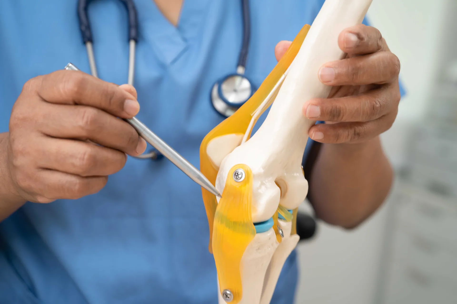 Knee Replacement