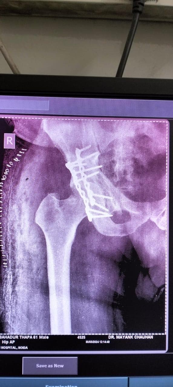 Joint and bone X-ray scan 10 used for orthopaedic diagnosis by Dr. Mayank Chauhan, Noida