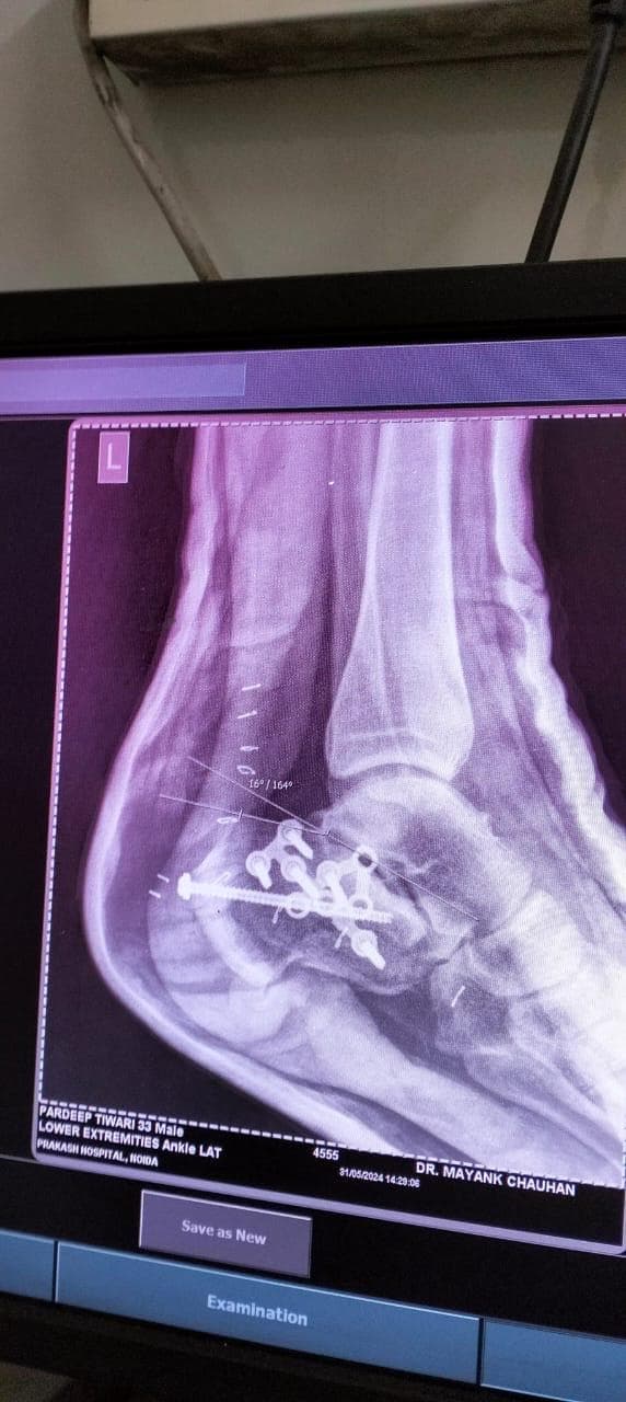 Joint and bone X-ray scan 12 used for orthopaedic diagnosis by Dr. Mayank Chauhan, Noida