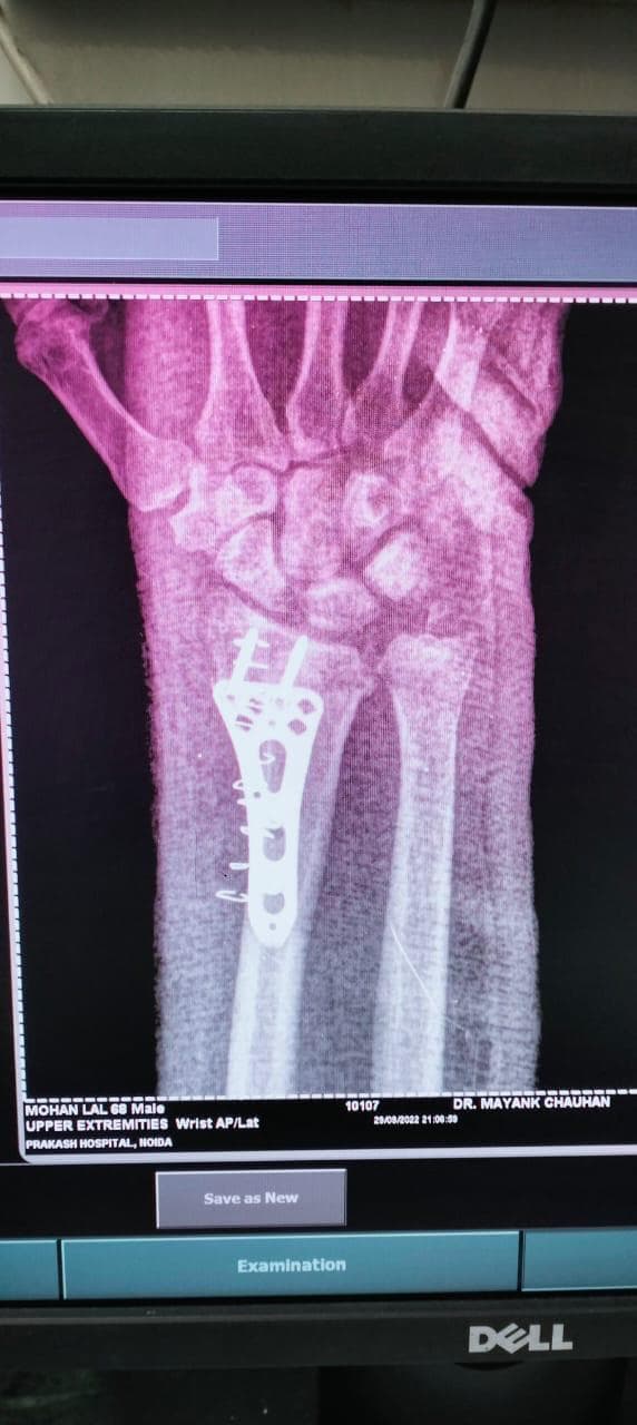 Joint and bone X-ray scan 8 used for orthopaedic diagnosis by Dr. Mayank Chauhan, Noida