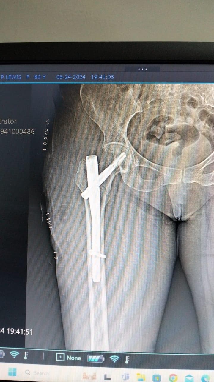 Joint and bone X-ray scan 9 used for orthopaedic diagnosis by Dr. Mayank Chauhan, Noida
