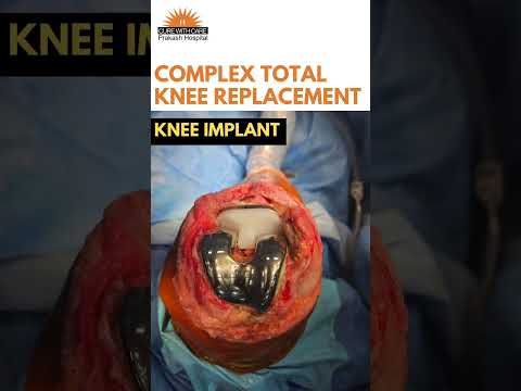Severe knee pain and difficulty walking?