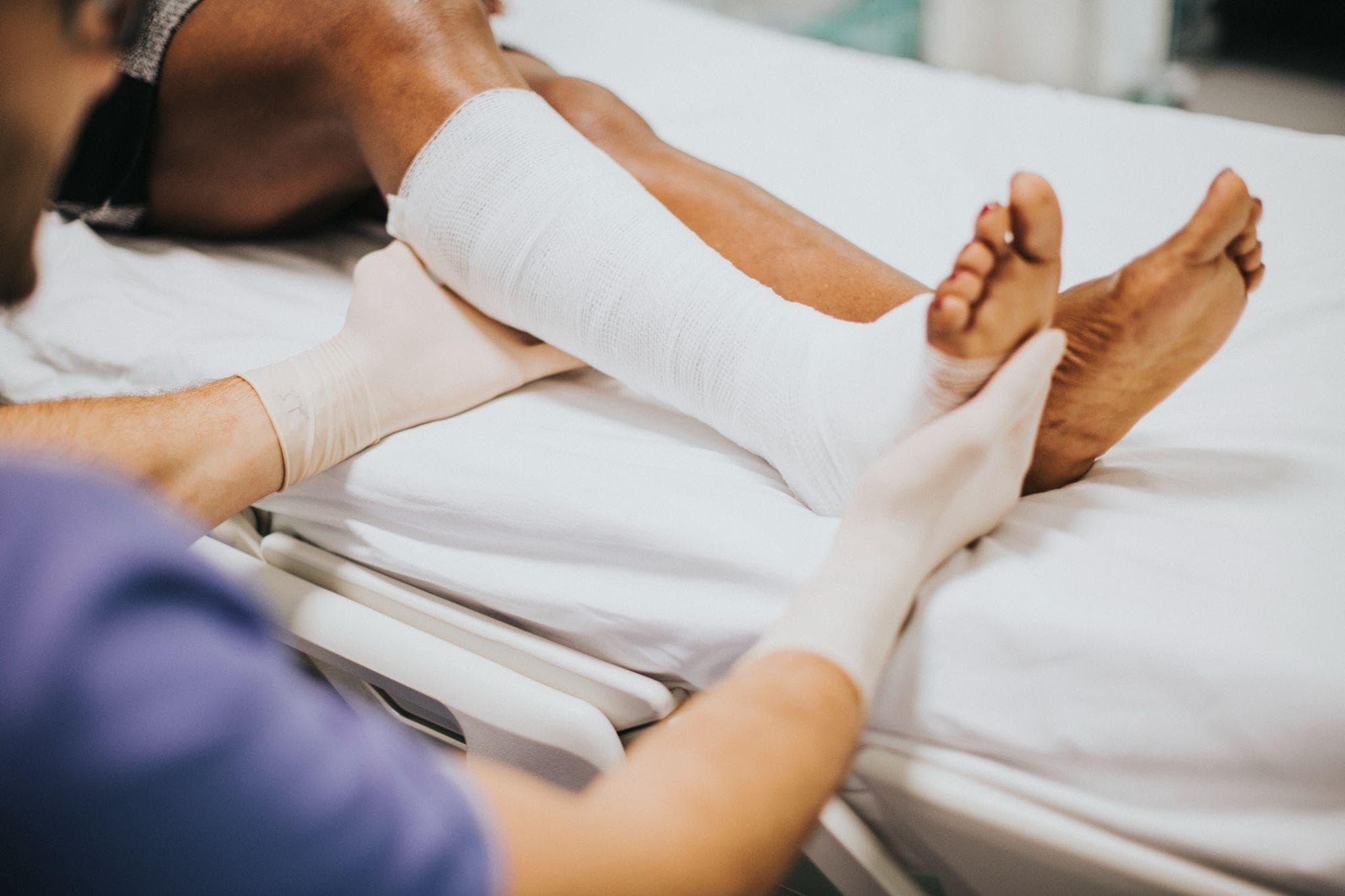 A Complete Guide On How Fractures Heal
