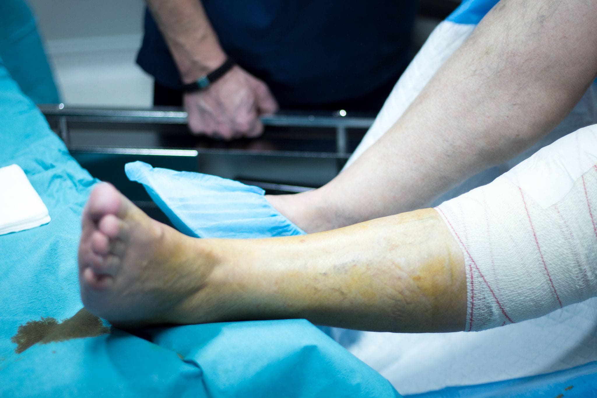 A patient lying on the bed in the clinic while doctors are operating on their leg for fracture surgery.