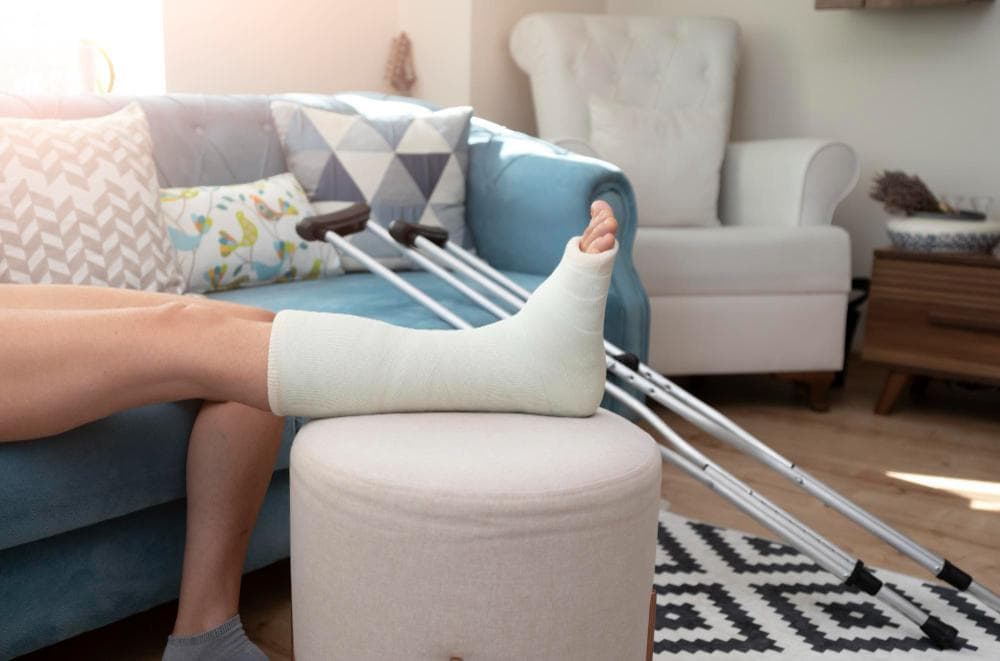 A close-up view of a leg of a female resting on a stool with a plaster on it for an ankle fracture, and clutches beside her.