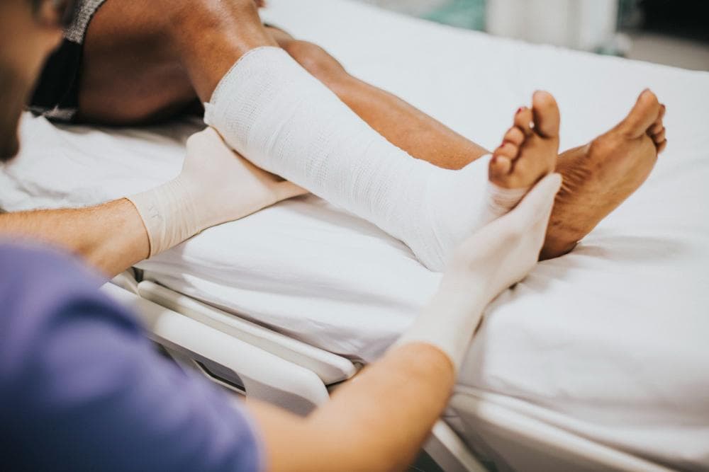 Do All Fractures Need Surgery?