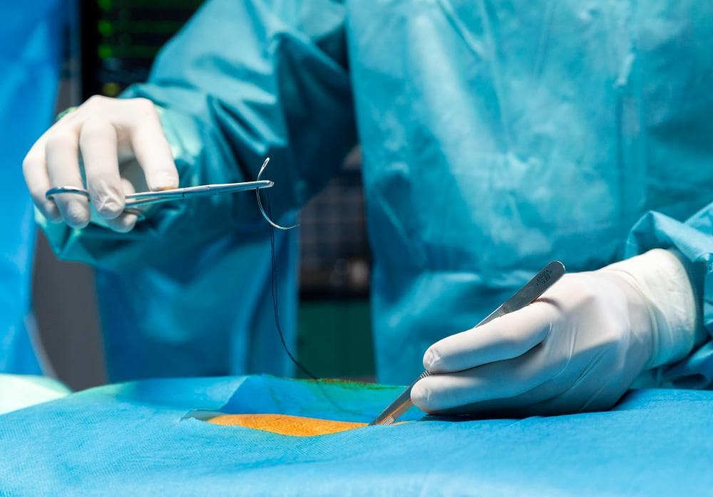 Open Surgical Procedures: Best Option For Complex Orthopedic Cases