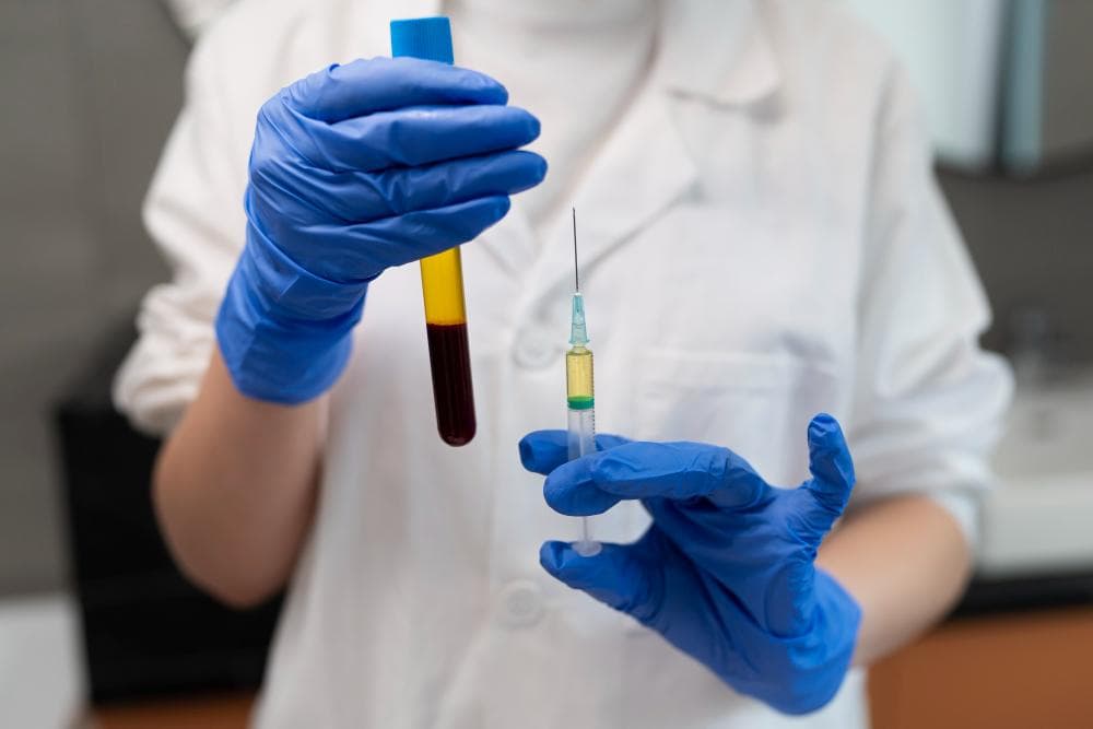 A healthcare professional wearing blue gloves holds up a test tube filled with yellow liquid and a syringe with a bright yellow fluid. The test tube is labeled with dark red liquid at the bottom.