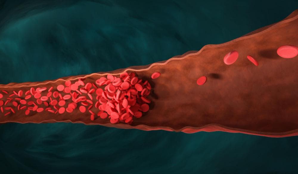 An anatomical illustration of a blood vessel shows red blood cells flowing through it. The blood cells are densely packed in some areas, indicating movement through a brownish tube that represents the vessel.