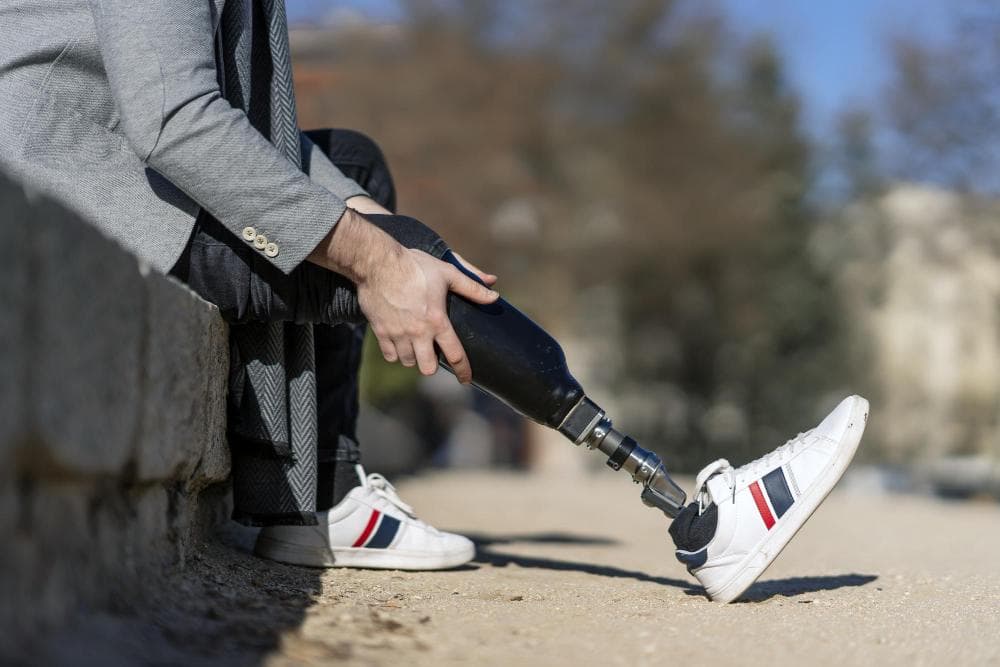 A man in a gray blazer is seated on a stone ledge, attaching a white athletic shoe to his prosthetic leg. The prosthesis is metallic, with a detailed joint mechanism visible. He looks focused with the background featuring a blurred park scene filled with trees.