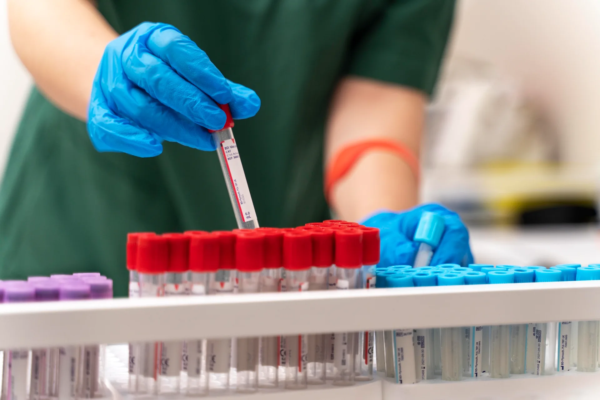 A laboratory technician in gloves holding a labelled blood sample tube