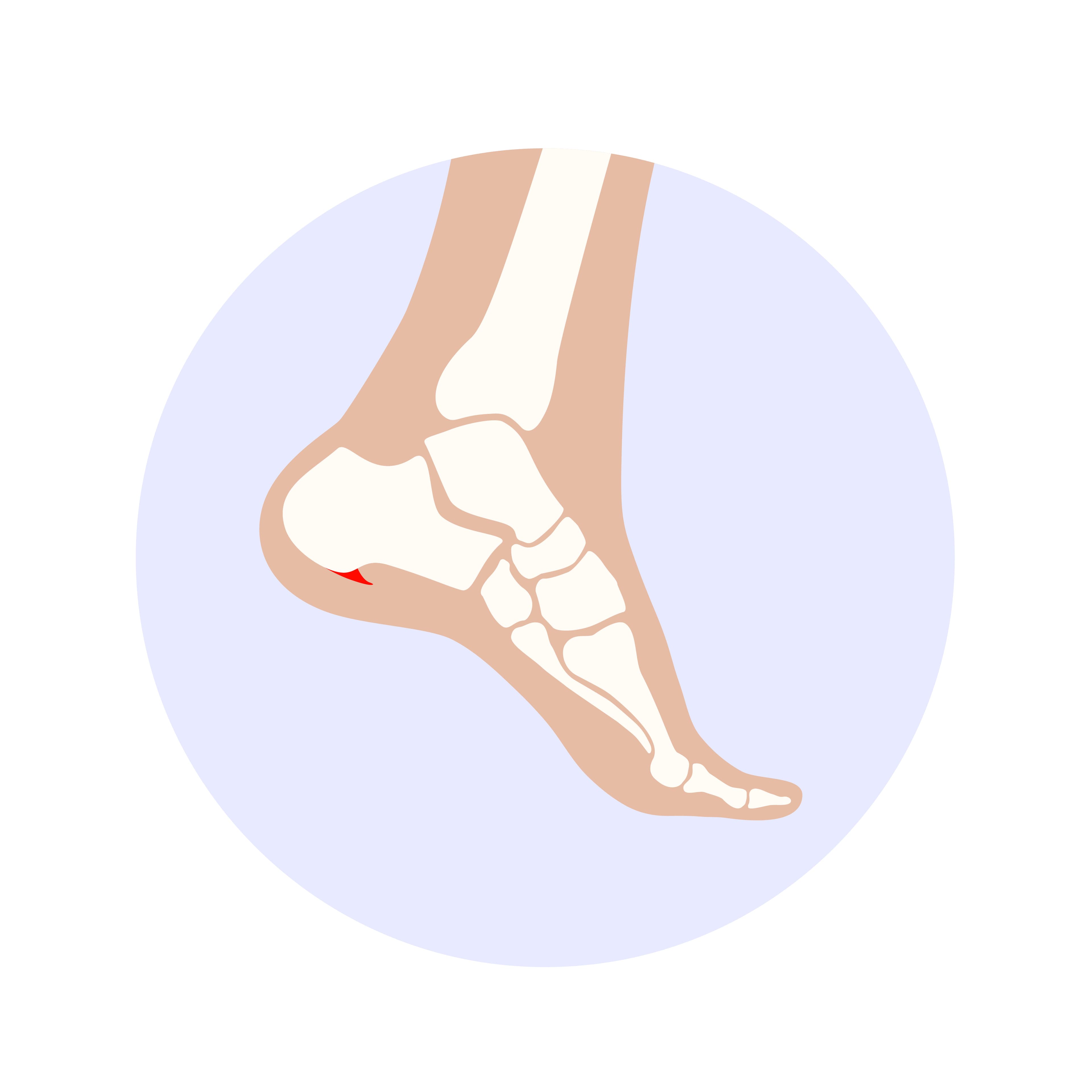 Bone Spurs (Osteophytes): What They Are, Why They Form, and When You Need Treatment