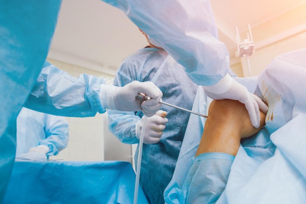 Joint Reconstruction Surgery - What It Is And When It's The Right Choice Over Replacement