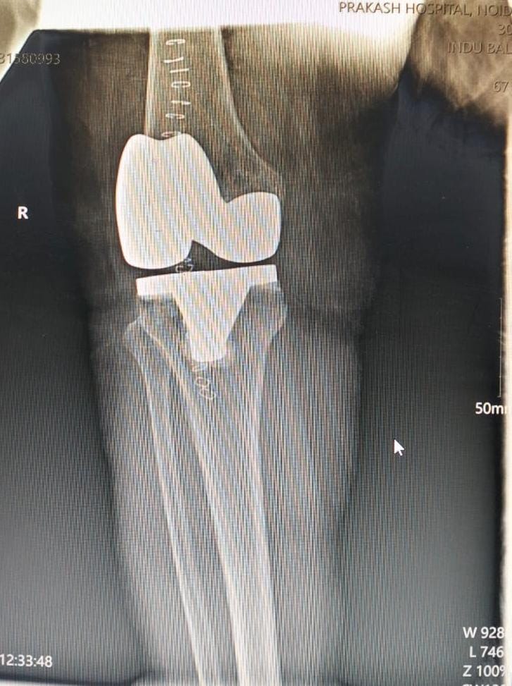 X-Ray image 7