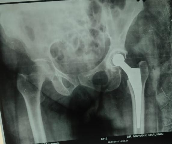 X-ray Image 4