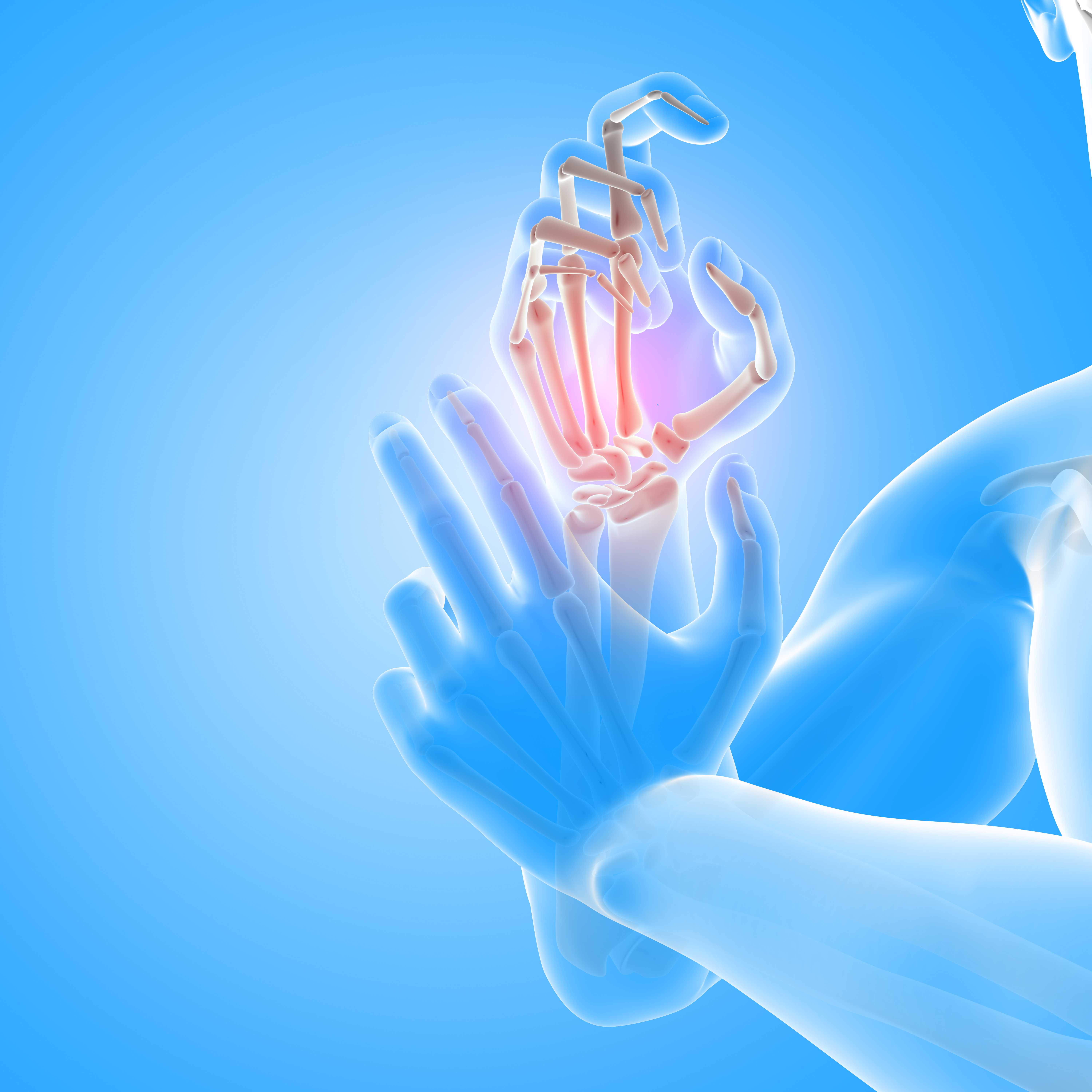 Joint Stiffness Treatment