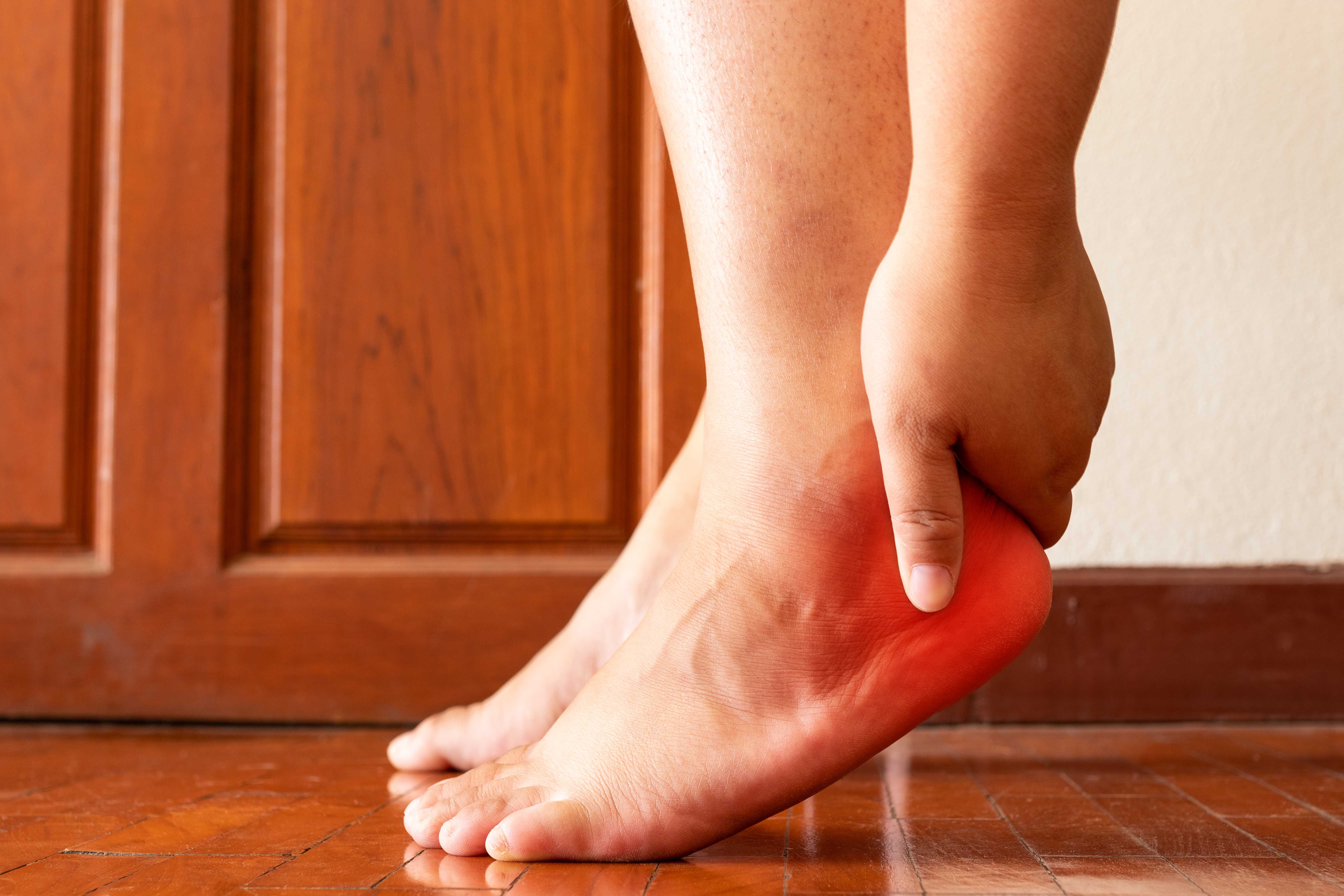Plantar Fasciitis Symptoms